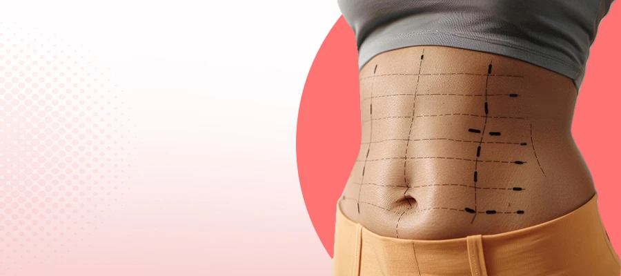 Liposuction Surgery Safe