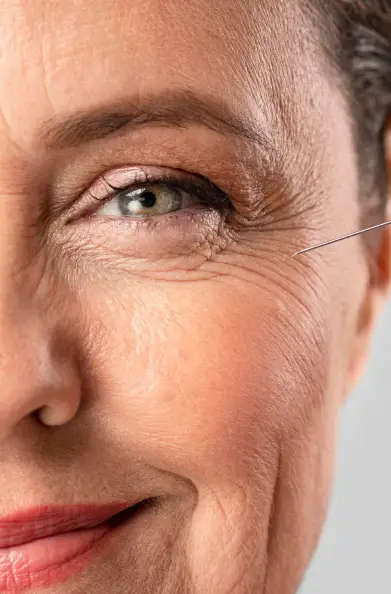 Botox Treatment
