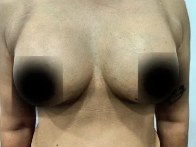 After Image
