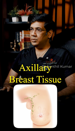 Axillary Breast Tissue