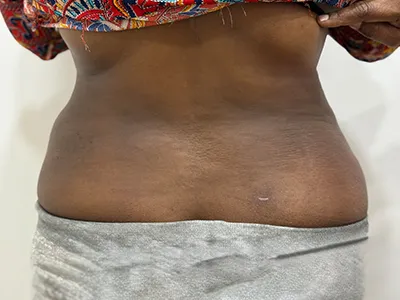 After Image