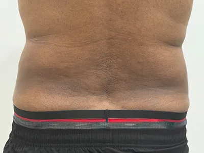 After Image