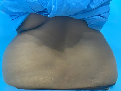 Before Image