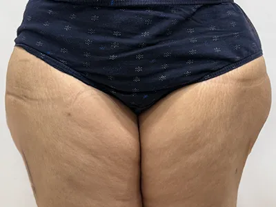 After Image