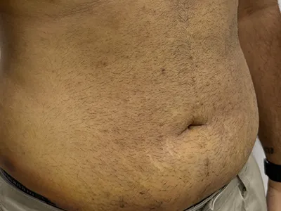 After Image