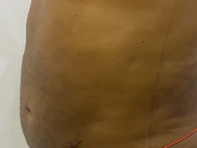 After Image