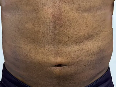 After Image
