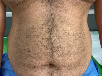Before Image