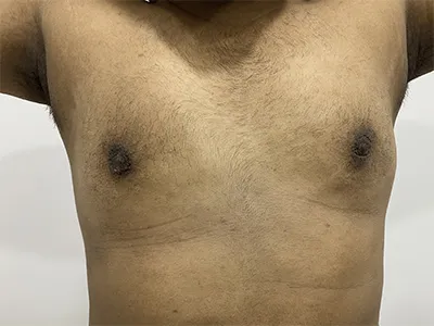 After Image