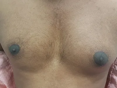 Before Image