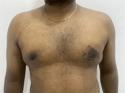 After Image