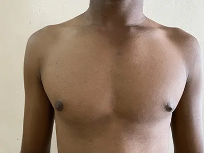Before Image