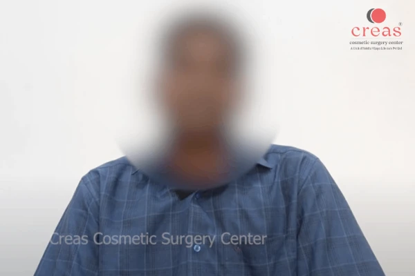 male-chest-fat-surgery-experience-1.webp