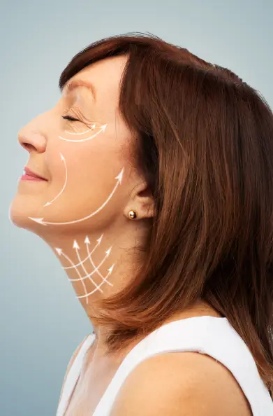Skin Tightening Thread Therapy