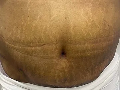 After Image