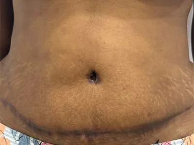 After Image