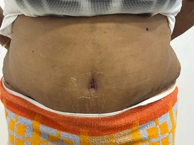 After Image