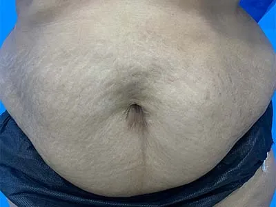 Before Image