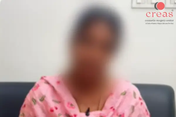 Chest Reduction Patient Feedback