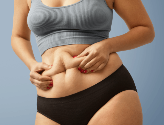 Tummy Tuck Cosmetic Surgery—Abdominoplasty